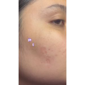 Twin Pack GLOW FX Glow Bomb Serum - 19% Brightening Power