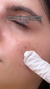 [CHARDE] Mela Peel Cream Mask 50ml/ Pigmentation & Dark Spots & Glow Care Intensive Spot Care Pigmentation Removal