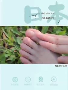 FROTH | Bunion Corrector Toe Spacer Adjustable Shoe Wearing