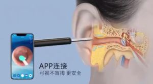 Wireless Wi-Fi Visual Ear Cleaner Smart Visual Sticks Otoscope 1080P HD Earpick Endoscope Ear Cleaning Kit Personal Health Care Ear Cleaner With Light Camera