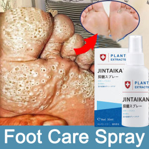 foot spray anti fungal spray Foot deodorant spray 30ml reatment of beriberi Athletes foot Foot peeling Foot odour 腳氣噴劑