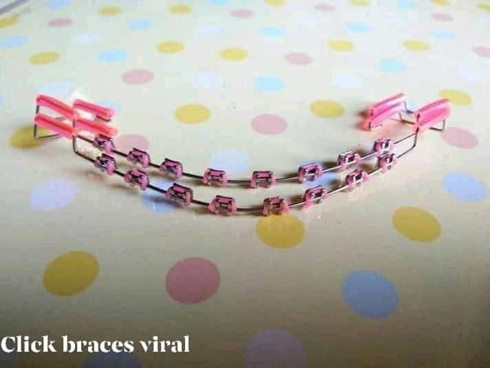 click braces design oringe rm10 untuk 1pcs shj Lazada
