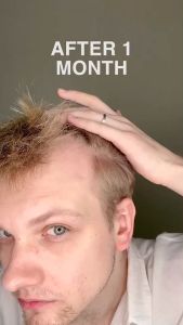 [S6866] Exocell X1 อย.ไทย อย.เกาหลี แอมพูล สเต็มเซลล์สด 10พันล้านเซลล์ เอ็กโซโซมสด stemcellสด ผิวกระจก กระชับรุขูปิง ผสมไม้เปียกเพื่อการแสดงผิว