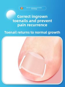 BAKULI | Ingrown Nail Correction Tool