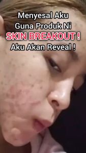 FELLE WHITE Collagen Pemutih Satu Badan Supplement Felle White Original Whitening Supplement Pemutih Badan Seluruh Cepat Collagen Supplement For Women 美白