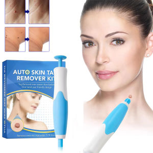 ชุดกำจัดไฝ หูด ติ่งเนื้อ 2 in 1 แบบไม่เจ็บปวด อุปกรณ์ทำความสะอาดผิวหน้า ดูแลผิวกาย กำจัดหูด จุดด่างดำ บำรุงผิวเพื่อสุขภาพและความงาม