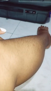 Dimples Hair Removal Cream Quick Gentle and Effective In 3 Minutes For Arms Legs and Bikini Line
