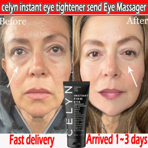 eyebag remover for men celyn eye cream for wrinkles eyebags remover original magic eye balm for dark under eye dewyhours eye cream for puffy eyes Anti Aging Fades Wrinkles Firming Brighten celyn eye tightener serum beauty of joseon eye cream30ml