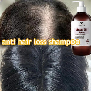 Anti hair loss hair growth shampoo Anti hair fall Promotes Hair Growth Thicker Say goodbye to bald Reduce Hair Dandruff Relieve itchy scalp