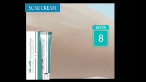 Scar Remover Cream Marks Repair Cream Brightening Skin Care Stretch Mark Dark Spot Remover