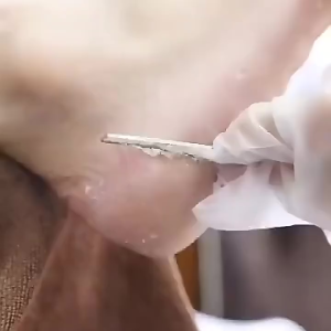 ของมาใหม่！ที่ขูดส้นเท้าแตก มีดขูดหนังเท้า สแตนเลส มีดโกนส้นเท้า