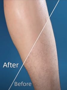 Kem tẩy lông vĩnh 60g An toàn không đau hiệu quả nhanh chóng cự tuyệt lông cứng và đenPhù hợp với mọi làn daserum triệt lông Triệt Lông chân lông tay lông bikini ria mép an toàn tiện lợi chi phí rẻ