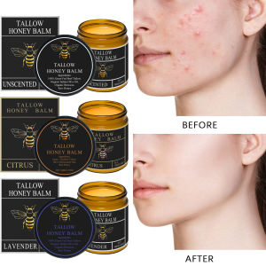 Beef Tallow Honey Moisturizer Grass Fed Whipped Tallow Face Cream Body Lotion Non Greasy Nourishing Fast Absorption Skin Care