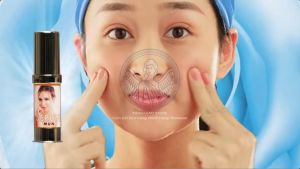 Serum Mụn Thorakao 7g Giúp Giảm Mụn Làm Dịu Da - Thorakao Store.