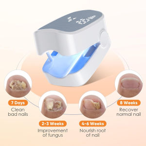 Nail Fungus Cleaning Laser Device Foot / Hand Nail Professional Nail Phototherapy Lamp Onychomycosis Fungus Cleaner 1PC or 2PCS