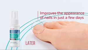 Dr.ville Nail Treatment Anti Fungal Nail Repair Spray Anti-Bacterial Nail Cuticle Care Promote Nails Grow Remove Onychomycosis Toe Nourishing Brighten