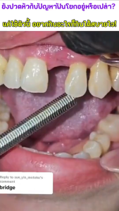 ORALHOEยาสีฟันสมุน ไวท์เทนนิ่ง เบกกิ้งโซดา ซ่อมแซมฟัน ขจัดคราบเหลือง ฟอกสีฟันขาว ปกป้องสุขภาพ เหมาะสำหรับทุกเพศทุกวัย สิ่งที่ต้องมีสำหรับครอบครัว 100g