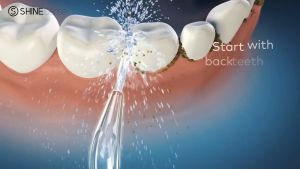 ShineSense Portable Oral Dental Irrigator Wate Flosser Waterproof Teeth Cleaner with 6 Jets Tips and 250ml Detachable Reservoir Rechargeable Dental Flosser for Brace Bridges Care Home Travel