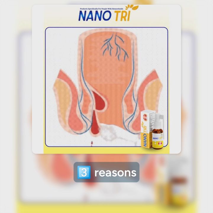 Nano Tri Hemorrhoid Relief - Sale Price - Buy 2 Get 1 Free - Instant Comfort and Healing
