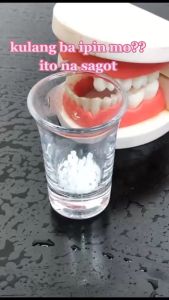 Temptooth Temporary Dental Kit 5000 Butir: Solusi Penambalan Gigi Palsu