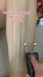 Bọ Cạp Sừng Đầu Bạc Diện Chẩn 3 Kích Thước - Đánh Gió Giải Cảm - Dụng Cụ Diện Chẩn