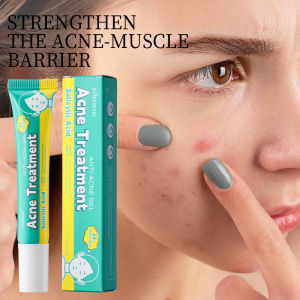 SADOER | Salicylic Acid Acne Cream Fast Gently Repair Acne Spot Scar Shrinks Pores Gel Brightens Skin Tone Tightens Skin Korean Skincare