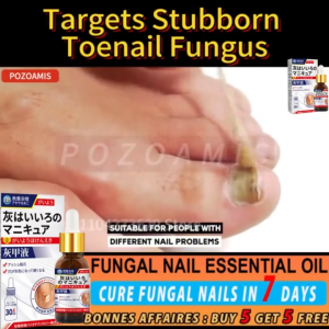 【7 วันเห็นผล】💛Nail Repair Essence Serum เซรั่มเล็บ เซรั่มซ่อมแซมเล็บ เซรั่มบำรุงเล็บ ฟื้นฟูเล็บเสียเร็ว บำรุงเล็บให้สวย