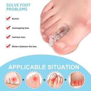 DIDI 1Pair Toe Orthosis Clip Pads Big Foot Bone Care Tools Splitter Thumb Hallux Valgus Bunion Corrector Overlap Separators