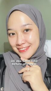 Ms glow asli ori Serum Acne Lifting Luminous Gold Whitecell Dna Peeling Retinol Elixir