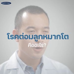 ProstoMAX โพรสโตแมกซ์ มีนู้กับวิตามินท่านชาย ส่งฟรี ปัสสาวะขัดอักเสบ ฉี่เล็ด เป็นช่วยเสริมสร้างเนื้อเยื่อ ผ่านมือหรือในส่วนต่าง ปนเลือด ปวดหน่วง ปลอดภัย บรรจุภัณฑ์ 30 ชั่วโมง