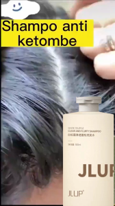 Sampo Anti Ketombe Dan Gatal 300ml Sampo Garam Laut Anti Gatal Anti KetombeAnti Rontok Shampoo Anti Ketombe Bergaransi 300ML