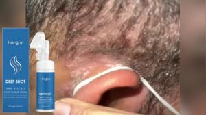 Moisturizing Hair Repair Cream Nourish Follicles Promote Hair Growth Mousse Prevent Hair Loss Treatment Product Scalp Care Serum
