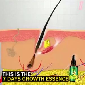 Minyak Penumbuh Rambut BPOM: Pilihan Terbaik untuk Pertumbuhan Rambut