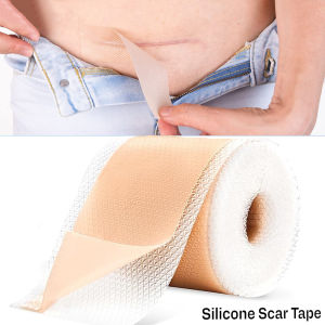 1Roll Silicone Scar Sheets - Silicone Scar TapeScars Silicone Strips Reusable Professional Scars Removal Sheets for C-Section