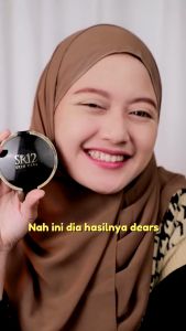 Bedak Padat SR12: Solusi Menutupi Bekas Jerawat & Flek Hitam