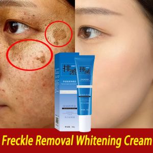 14 Days Freckle Removal Cream Powerful Removing Age Dark Spots Remove Pigmentation Wrinkles Whitening Remove Mole Freckles and Dark Spots Brightening Skin Spot Treatment Cream 20g