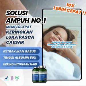 Kapsul Kutuk Ikan Gabus ALCHANNA - Supplement Herbal dari Ikan Gabus Mempercepat Proses Pengeringan & Penyembuhan Jahitan Operasi Caesar/ Normal Luka Setelah Melahirkan - 60 Kapsul