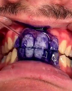 v34 colour corrector hismile Teeth Whitening purple teeth whitening tooth my smile toothpaste original Tooth Stain Removal pemutih gigi kuning ubat gigi kuning tartar remover