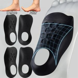 Orthopedic Insoles for Flat Foot O-Shaped Legs Correction Arch Support Plantar Fasciitis Health Sole Men Women Foot Care Insert