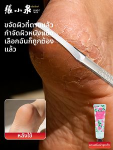Zhang Xiaoquan | Callus Removal Foot Tool