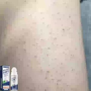 East Moon Roll-On Pati Pembaikan Selepas Bercukur Selepas Mencukur dan Mencabut Bulu Kekeringan Kulit Kemerahan Roll-On Pelembap Lembut