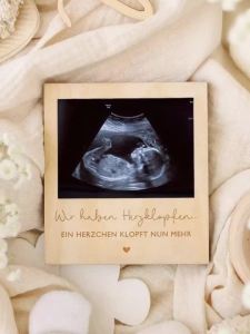 Ultrasound Pregnancy Announcement Sign Wooden Photobooth Props Baby First Photo Picture Frame Wall Tabletop Picture Frames