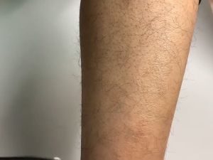 Painless Hair Remover Epilator Skin Exfoliator Body Arm Legs Eraser / Alat Buang Bulu Halus