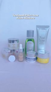 Jglow Skincare Paket Acne Extra Salep Totol 100% Original Skincare Wajah Berjerawat 1 paket skincare isi 5 wajah glowing BPOM