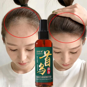 Unclog Pores & Oil Control Hair Repair Essence Safe & Non-Irritating Roots Booster Tonic Improve Dry Curly Hair Roots Booster Tonic