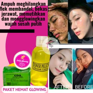 Paket Pemutih Glowing hemat Terlaris Ampuh Menghilangkan Flek Dalam 5 Hari
