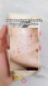 Sabun Beras Herbal SR12 60gr - BPOM / Rice Soap SR12 / Sabun Kulit Wajah Berjerawat & Sensitif