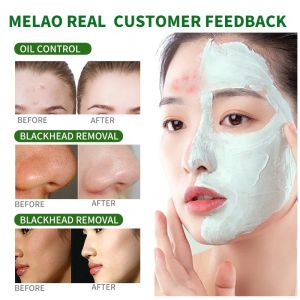 Kale Clay Mask Pore Clean Clay Mask 100gr Anti Pores Acne Clay Mask Pore Clarifying Wask