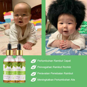Serum Penumbuh Rambut Botak Herbal Hair Growth Serum 50g Hair Tonic Penumbuh Rambut Serum Menebalkan & Menutrisi Rambut 7 Hari Penumbuh Rambut Cepat