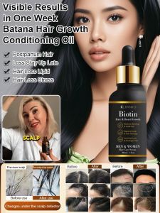 Batana Hair Growth Conditioning Oil Organic Nourish Repair Hair Anti-Frizz Hair Oils For Hair Growth